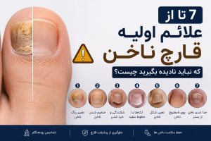 علائم اولیه قارچ ناخن